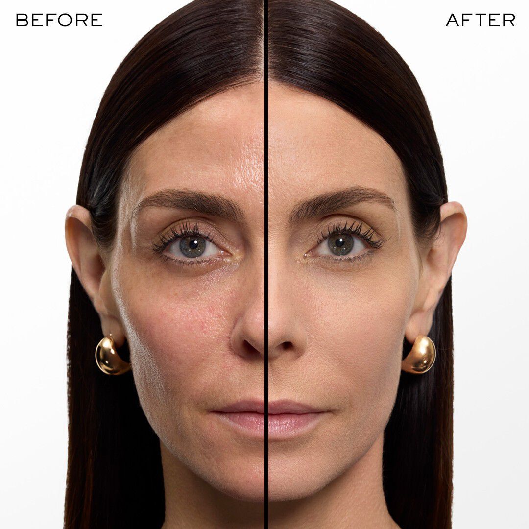 Before and after visual