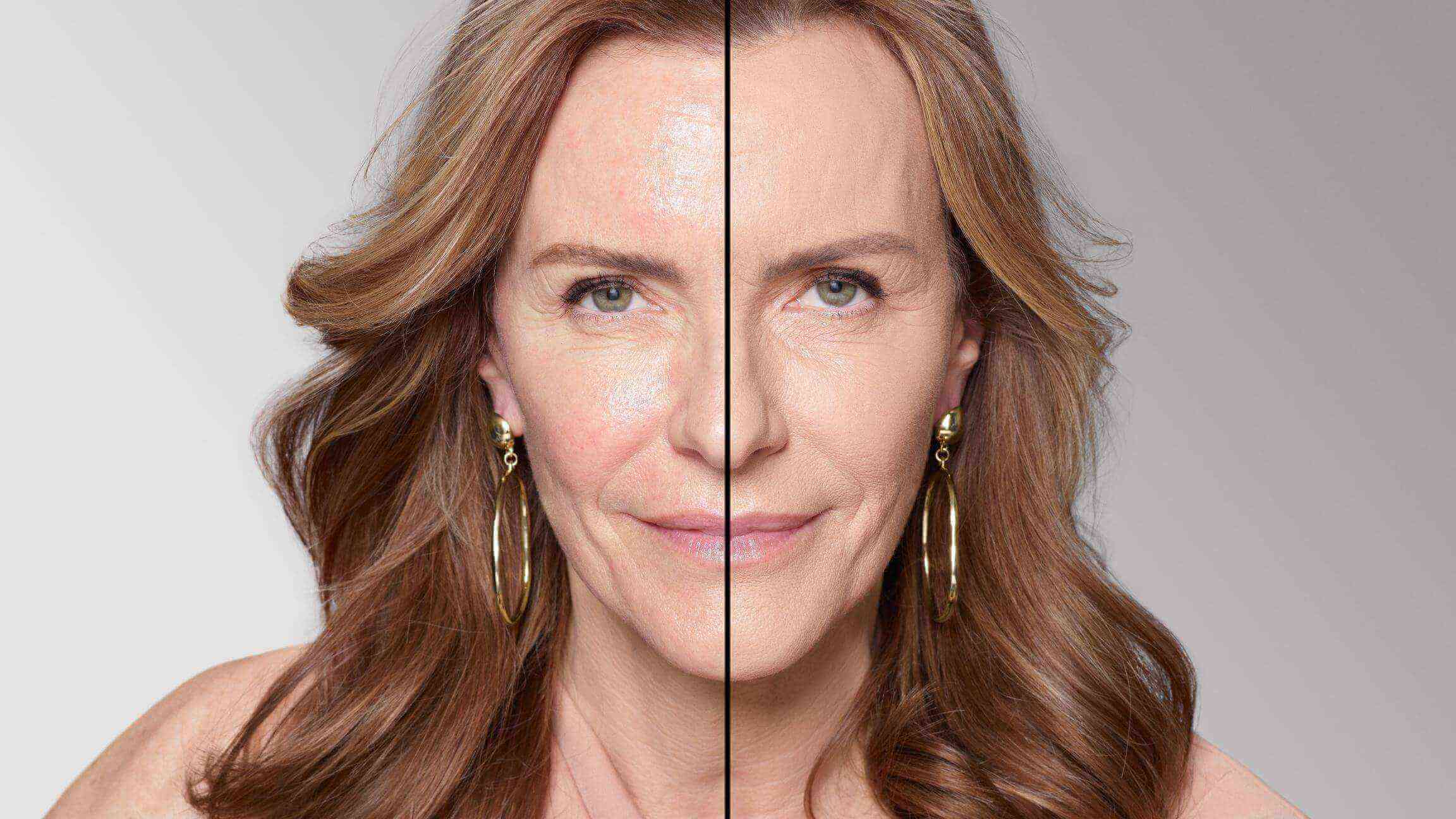 BEFORE/AFTER