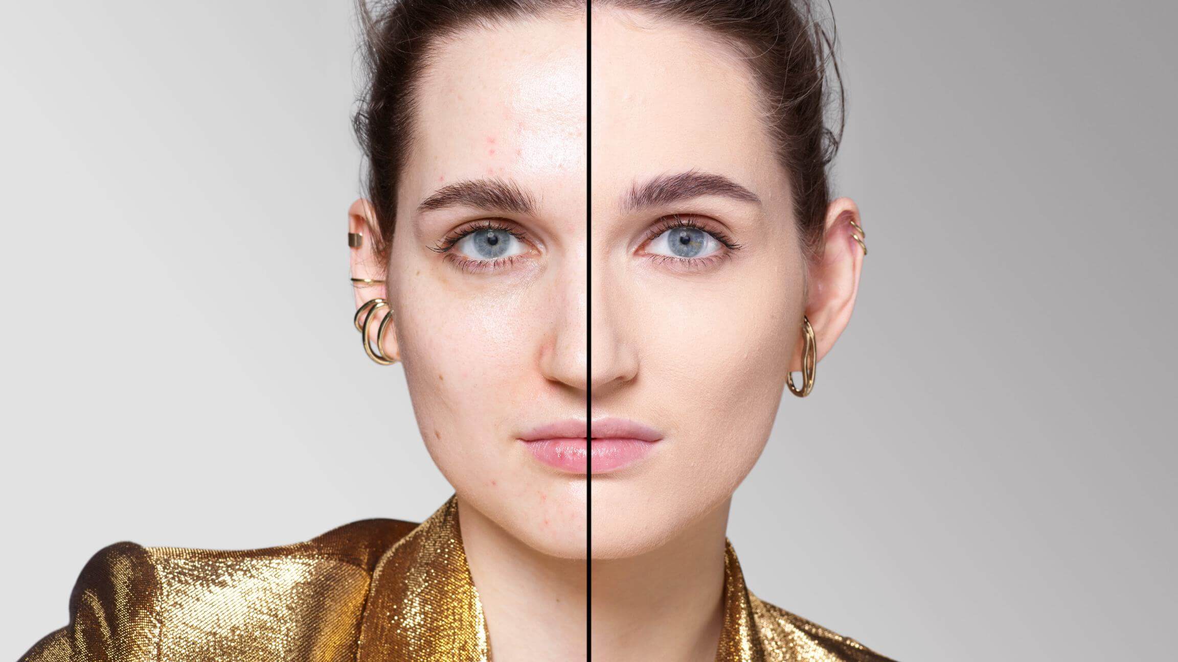 BEFORE/AFTER