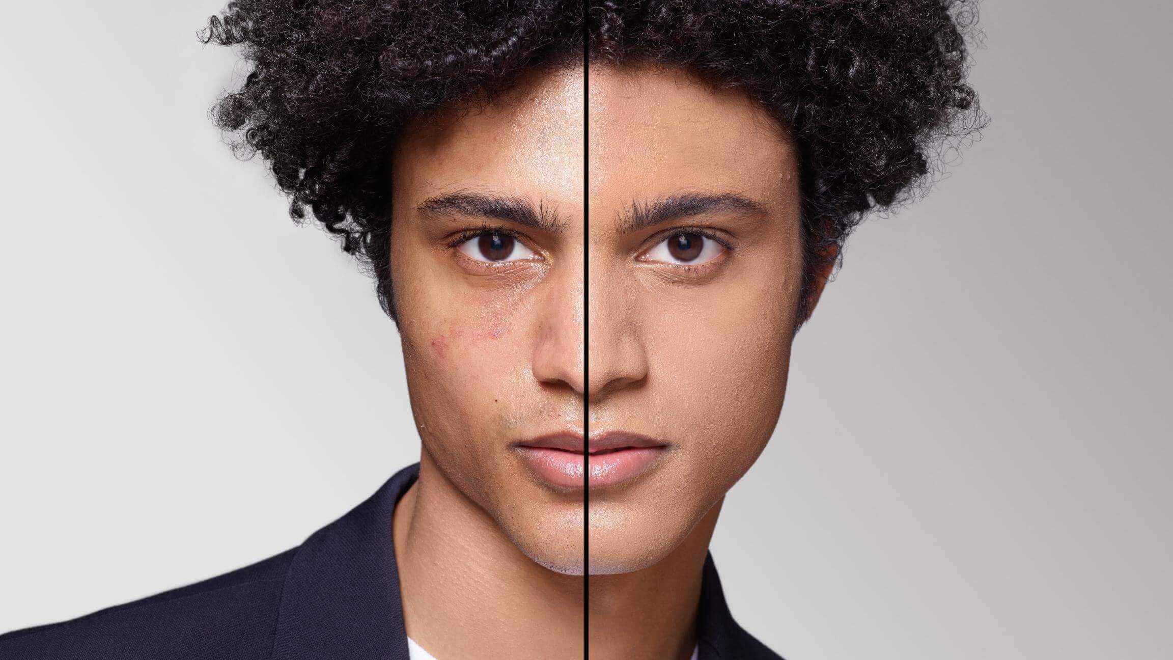 BEFORE/AFTER